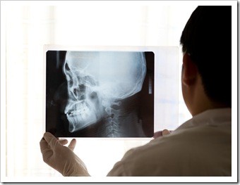 Fort Mill TMJ Jaw Pain Treatment